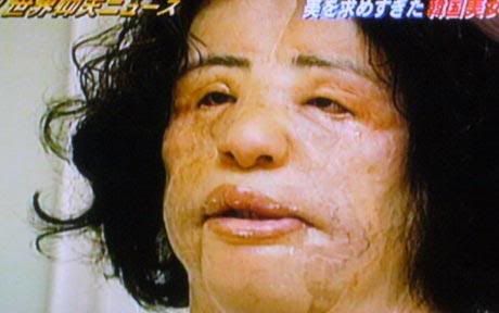 A Korean woman addicted to plastic surgery has been left unrecognisable after her obsession led her to inject cooking oil into her face.